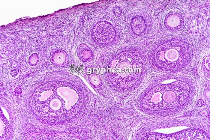 Ovaire de Lapine - follicules x25 - gryphea.com